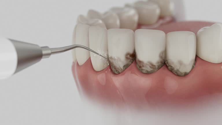 Reliable Emergency Dentist contractor in Chipley, FL by Smile Center Dentistry